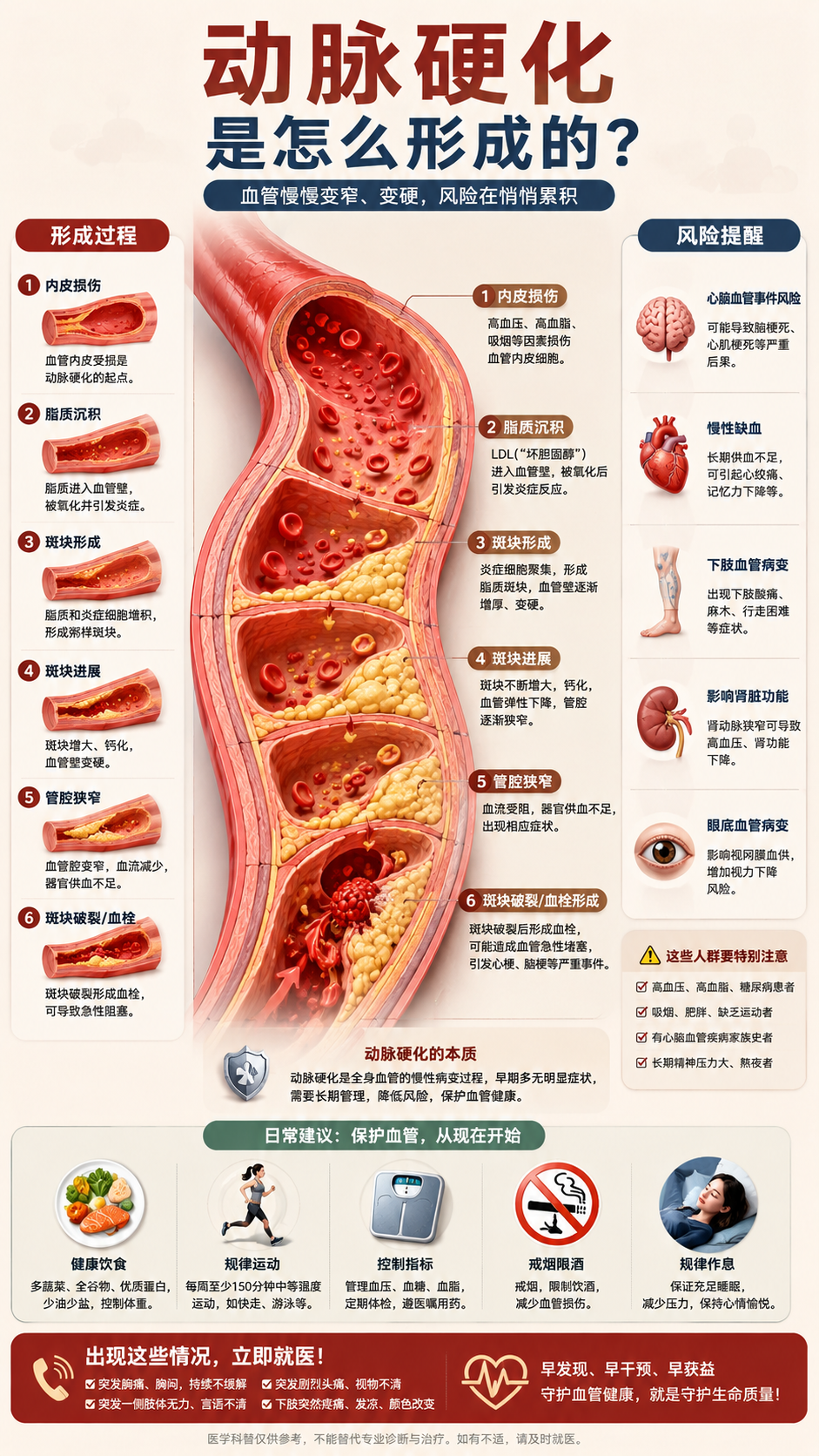 动脉硬化图解