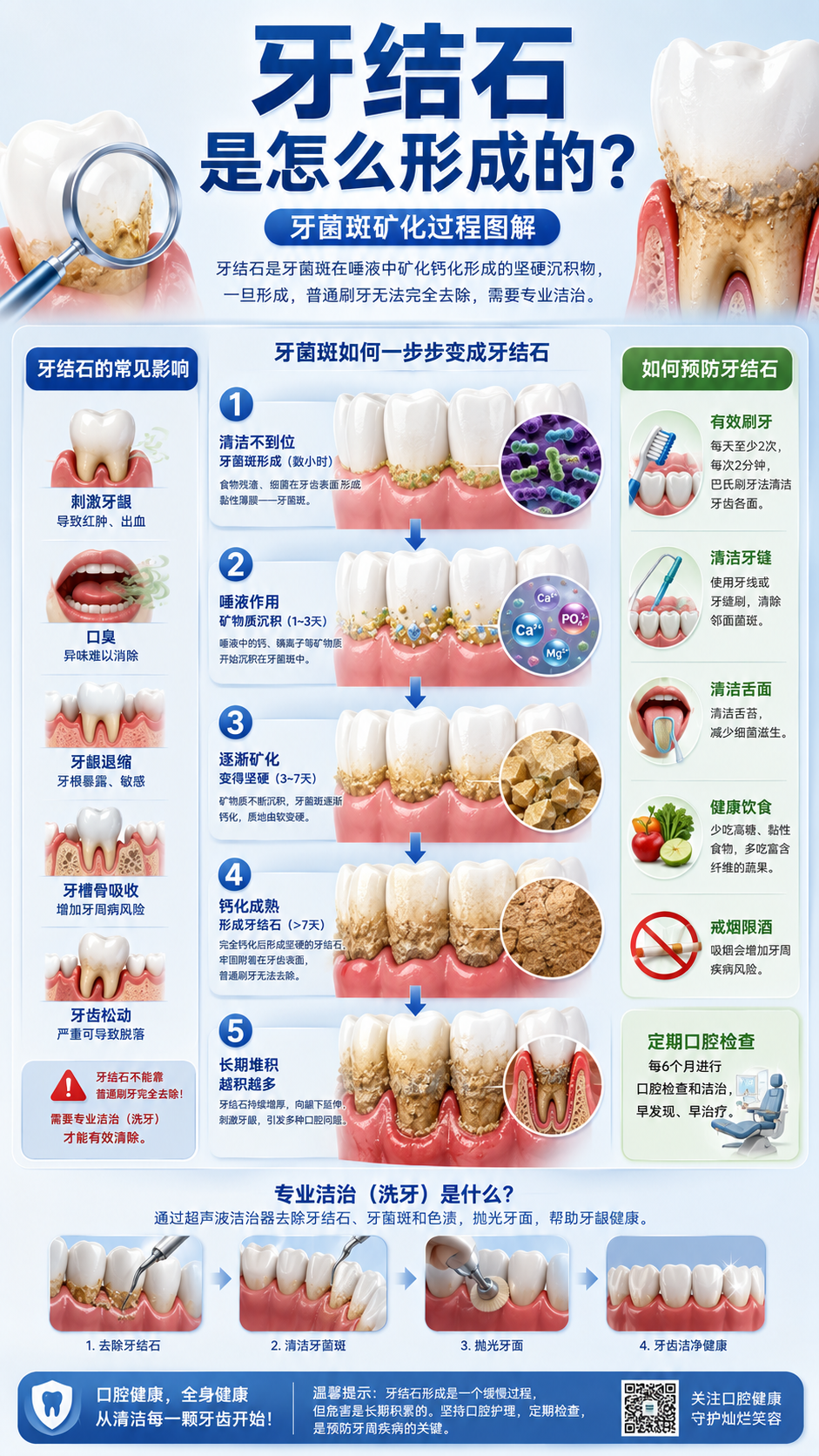 牙结石图解